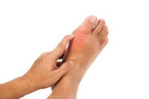 Gout and Foot Pain